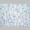 Neuronas Nissl 11.jpg